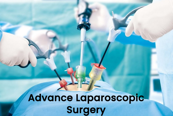 Advance Laparoscopic Surgery