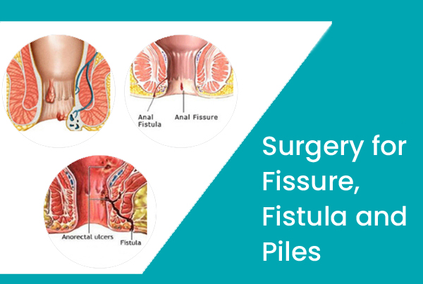 Surgery for Fissure, Fistula and Piles